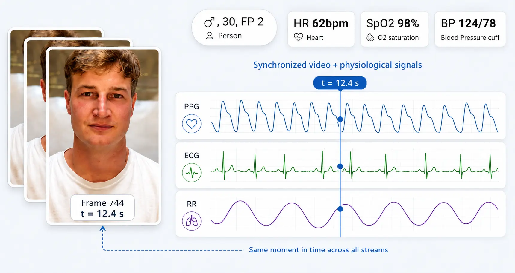 Example VitalVideos data sample showing synchronized face video, PPG, ECG, respiration, heart rate, SpO2 and blood pressure signals